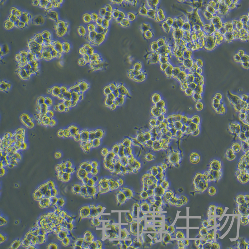 Neuro-2a（小鼠脑神经瘤细胞）YB-72168MC,Neuro-2a