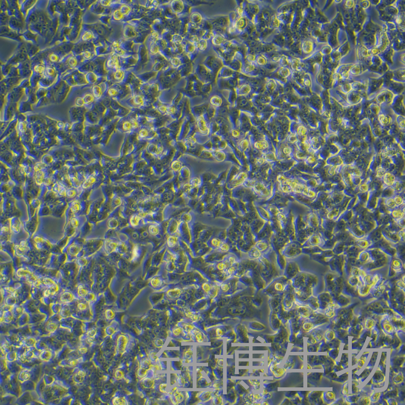 RM-1（小鼠前列腺癌细胞）YB-72198MC,RM-1