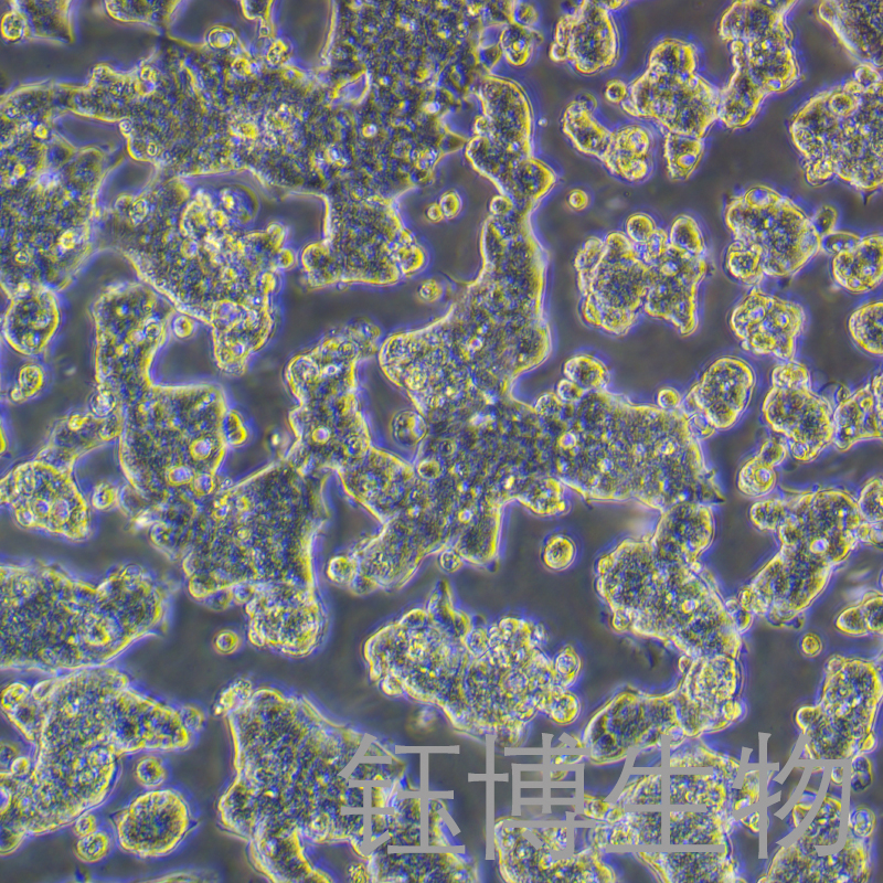 T84（人结肠腺癌肺转移细胞）YB-71229HC,T84