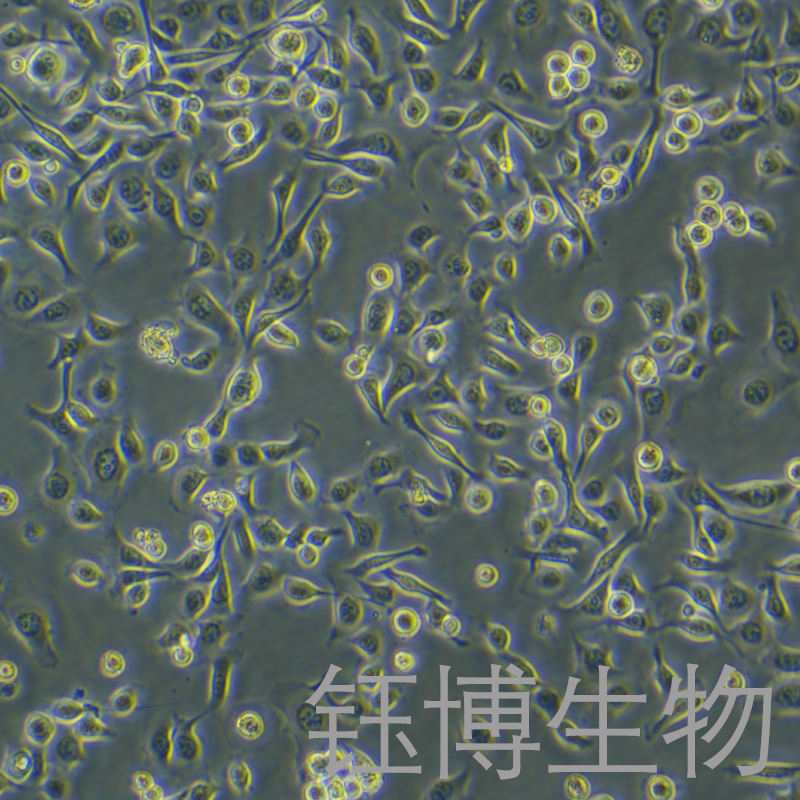 TE-1（人食管癌细胞）YB-71231HC,TE-1