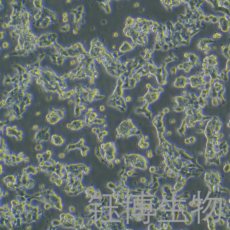 VCaP（人前列腺癌细胞）YB-71241HC,VCaP