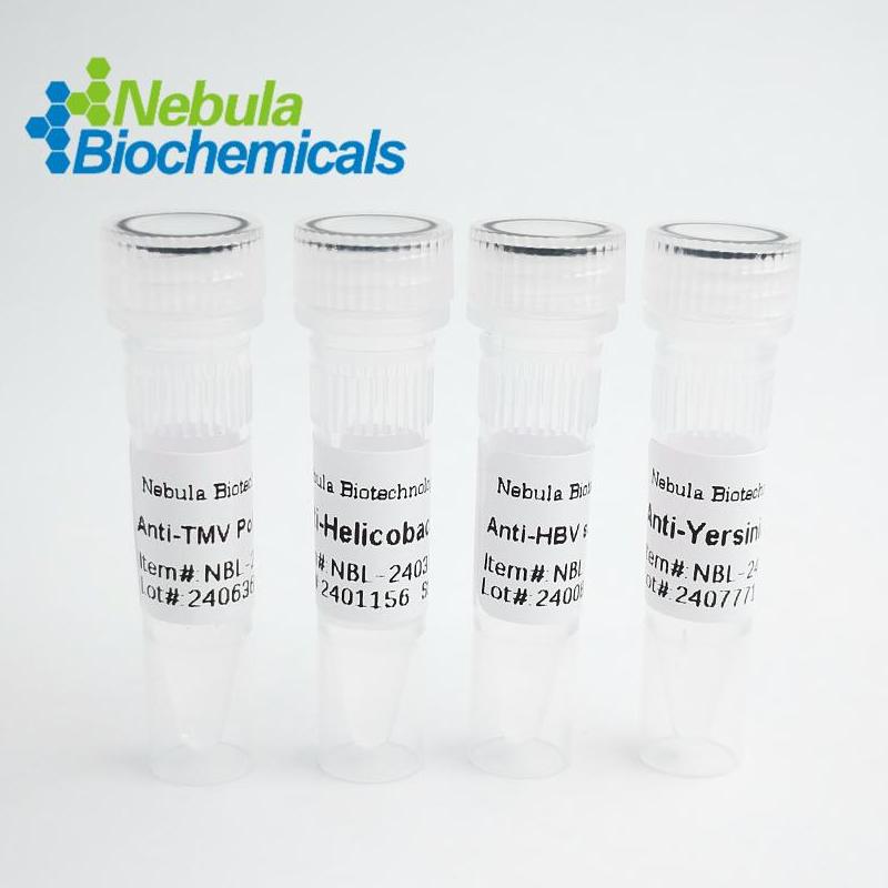 NebuSelect?CHIKV E1假病毒[抗原],NebuSelect? CHIKV E1 Pseudovirus [Antigen]