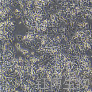 SK-BR-3 [SKBR3]（人乳腺腺癌细胞）YB-71211HC