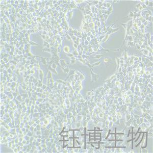 NG108-15 [108CC15]（小鼠神經(jīng)細(xì)胞瘤與大鼠神經(jīng)膠質(zhì)瘤之融合細(xì)胞）YB-72170MC