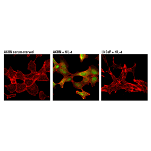 磷酸化信号转导与转录激活因子6（Tyr641）（D8S9Y）兔单克隆抗体,Phospho-Stat6 (Tyr641) (D8S9Y) Rabbit mAb