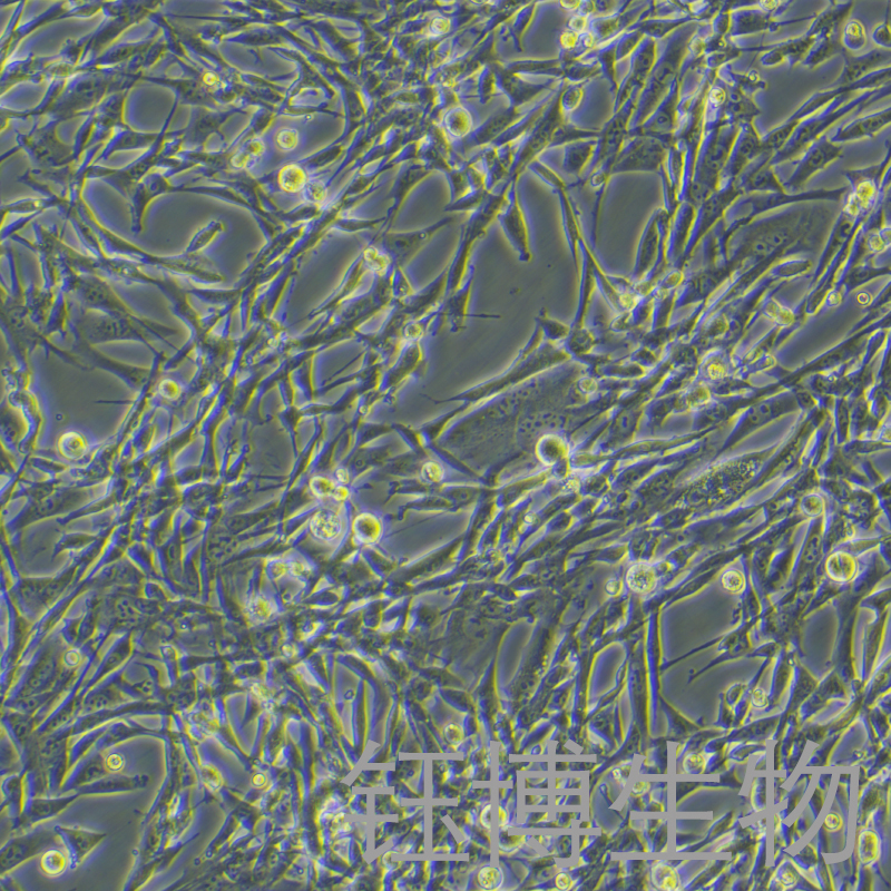 BHK-21 [C-13]（仓鼠肾成纤维细胞）YB-75034OC,BHK-21 [C-13]