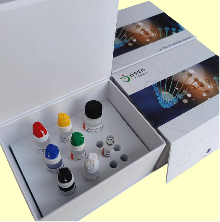 腺病毒F型探针法荧光定量PCR试剂盒,Adenovirus(AV)