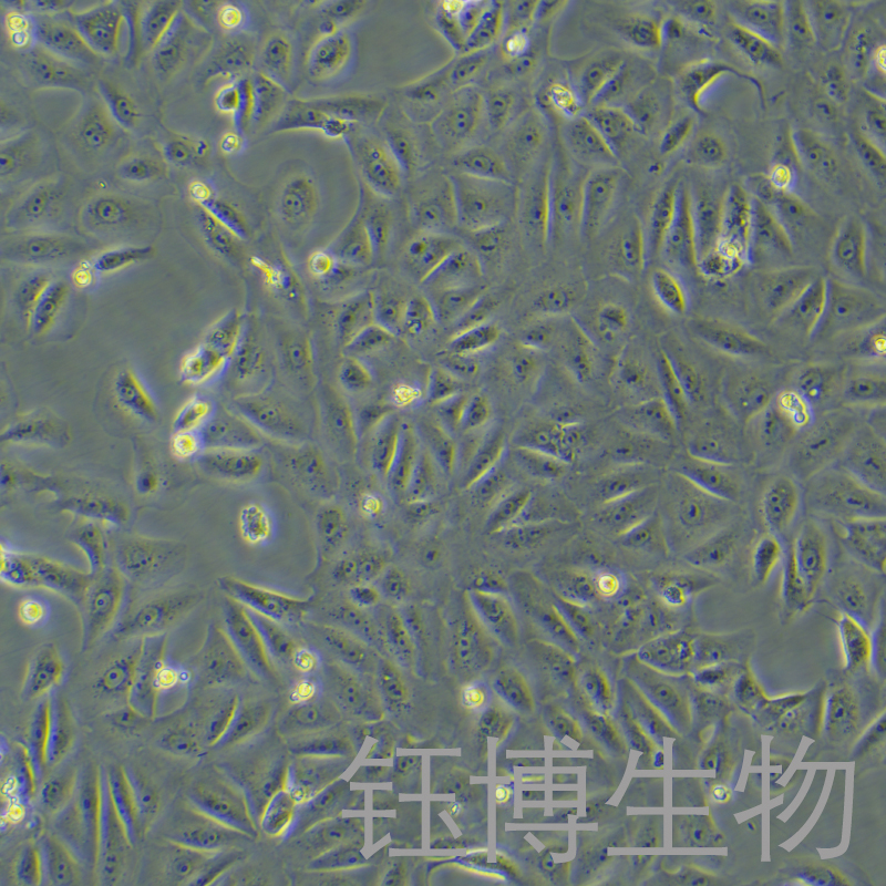 VERO C1008 [Vero E6]（非洲绿猴肾细胞）YB-75491OC,VERO C1008 [Vero E6]