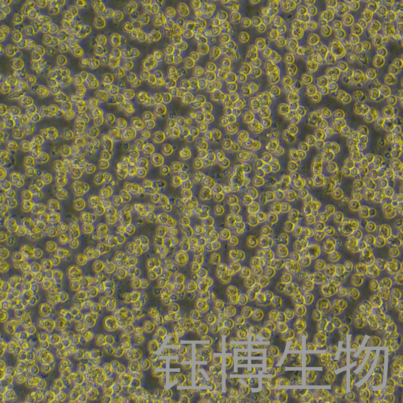 KG-1A（人急性髓性白血病细胞）YB-71680HC,KG-1A