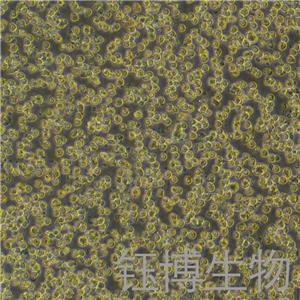 KG-1A（人急性髓性白血病细胞）YB-71680HC,KG-1A