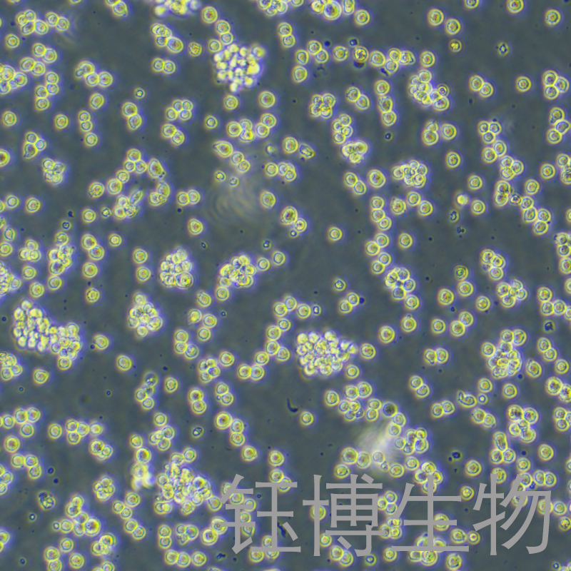 RAJI-LUC（人口腔鳞癌细胞-荧光素酶标记）YB-71189HC-L,RAJI-LUC
