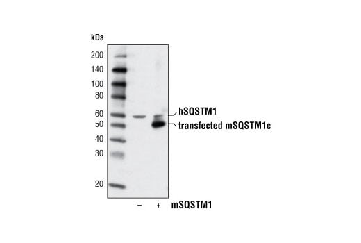 SQSTM1/p62 抗体,SQSTM1/p62 Antibody