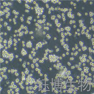 RAJI-LUC（人口腔鳞癌细胞-荧光素酶标记）YB-71189HC-L