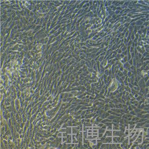 CFPAC-1（人胰腺癌细胞）YB-71601HC