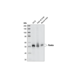 帕金蛋白（Prk8）小鼠单克隆抗体,Parkin (Prk8) Mouse mAb