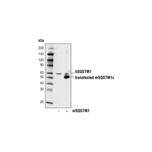 SQSTM1/p62 抗体,SQSTM1/p62 Antibody