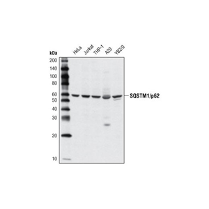 SQSTM1/p62 抗体,SQSTM1/p62 Antibody