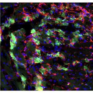 人羊膜间充质干细胞