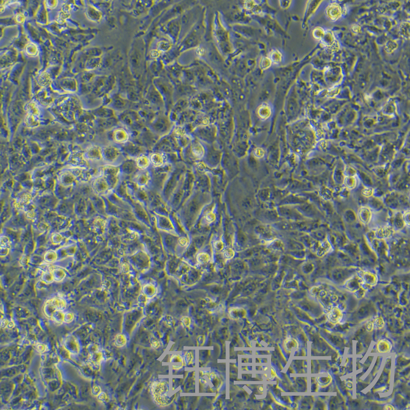 MHCC97-H（高转移人肝癌细胞）YB-71656HC,MHCC97-H