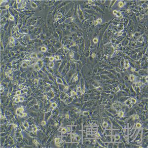 MHCC97-H（高转移人肝癌细胞）YB-71656HC,MHCC97-H