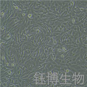 U251 MG（人神经胶质细胞瘤细胞）YB-71702HC