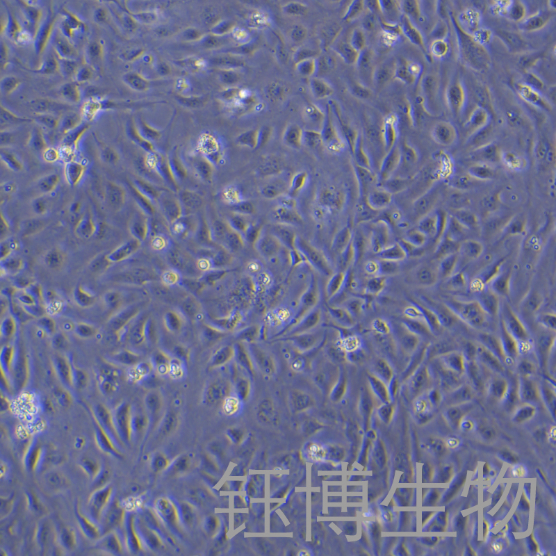 D407（人视网膜色素上皮细胞）YB-71735HC,D407