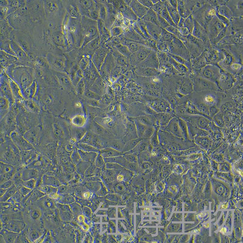 SNU-216（人胃癌细胞）YB-71739HC,SNU-216