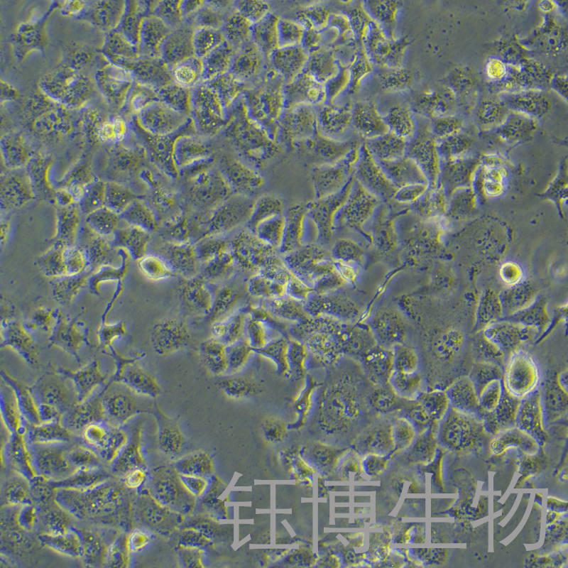 TU 686（人喉癌细胞）YB-71738HC,TU 686