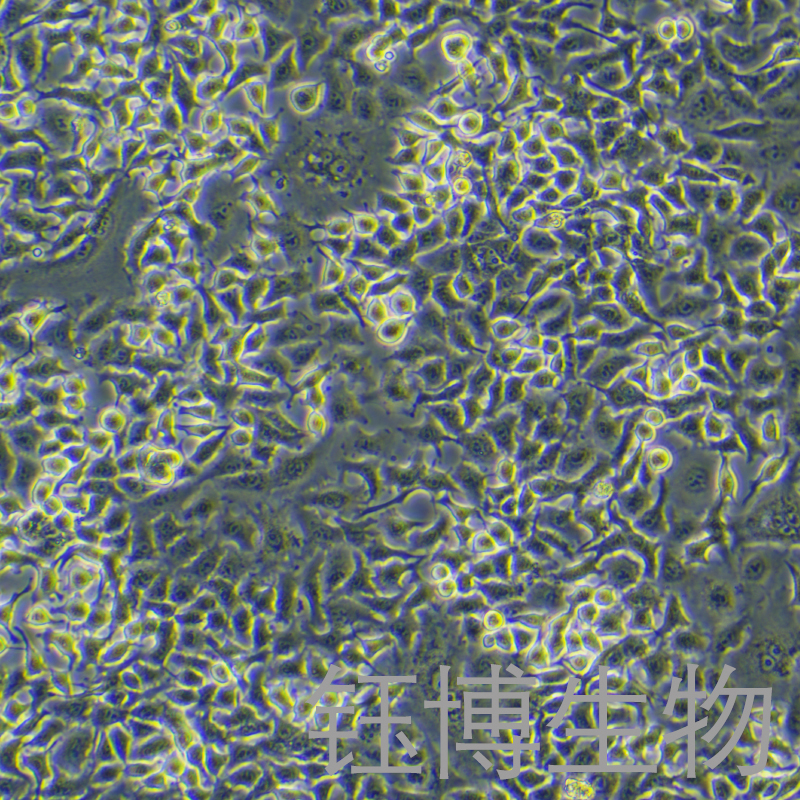 U373（人脑胶质瘤细胞）YB-71740HC,U373