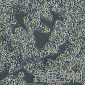 HepG2/C3A（人肝癌细胞）YB-71730HC