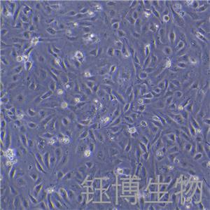 D407（人视网膜色素上皮细胞）YB-71735HC