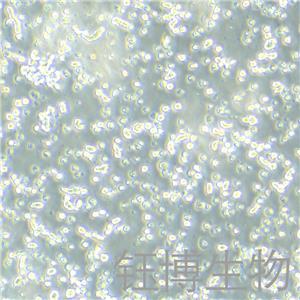 KCL-22（人慢性粒细胞白血病细胞）YB-71745HC,KCL-22