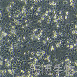 6-10b（鼻咽癌细胞株）YB-71753HC