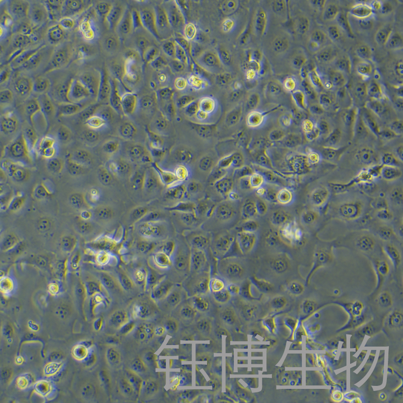 HCE-T（人角膜上皮细胞）YB-71756HC,HCE-T