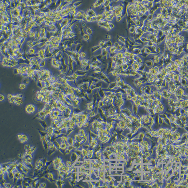 C666-1（人鼻咽癌细胞）YB-71757HC,C666-1