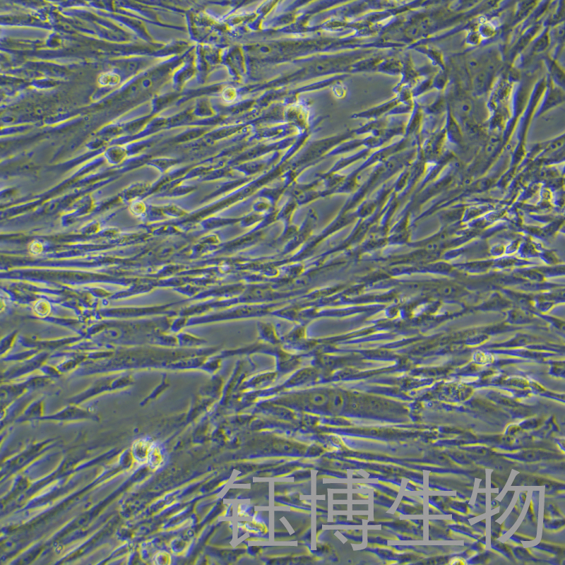 HMSC-bM（人骨髓间充质干细胞）YB-71763HC,HMSC-bM