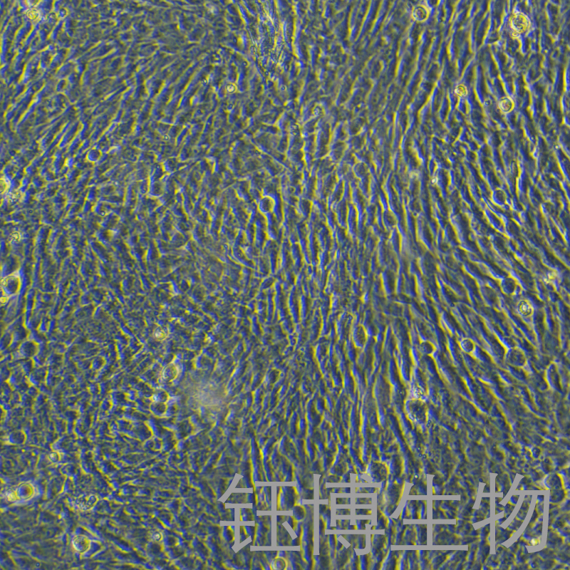 HPASMC（人肺动脉平滑肌细胞）YB-71772HC,HPASMC