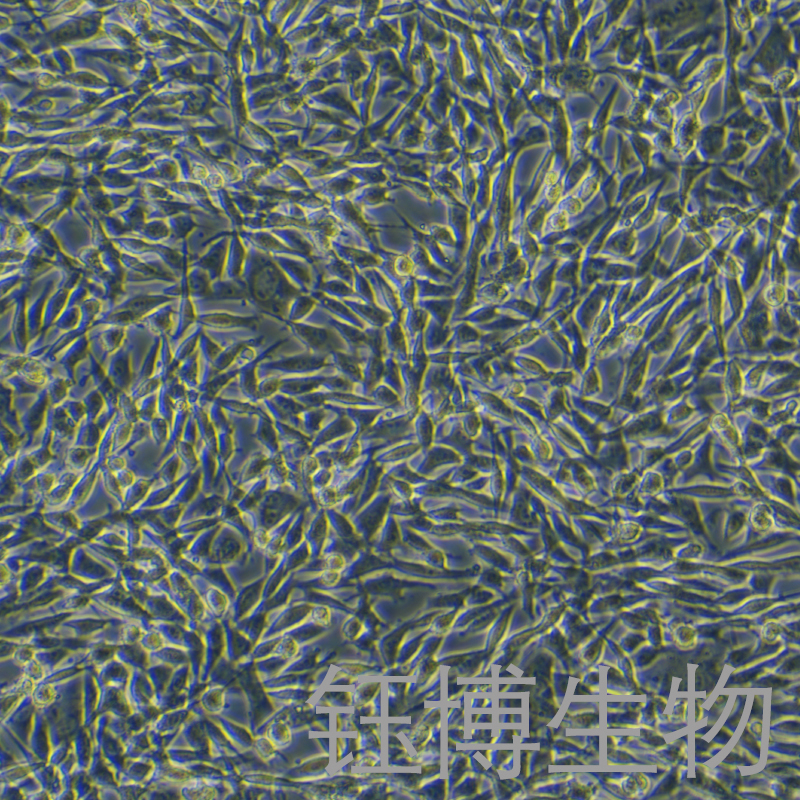 WM115（人黑色素瘤细胞）YB-71774HC,WM115