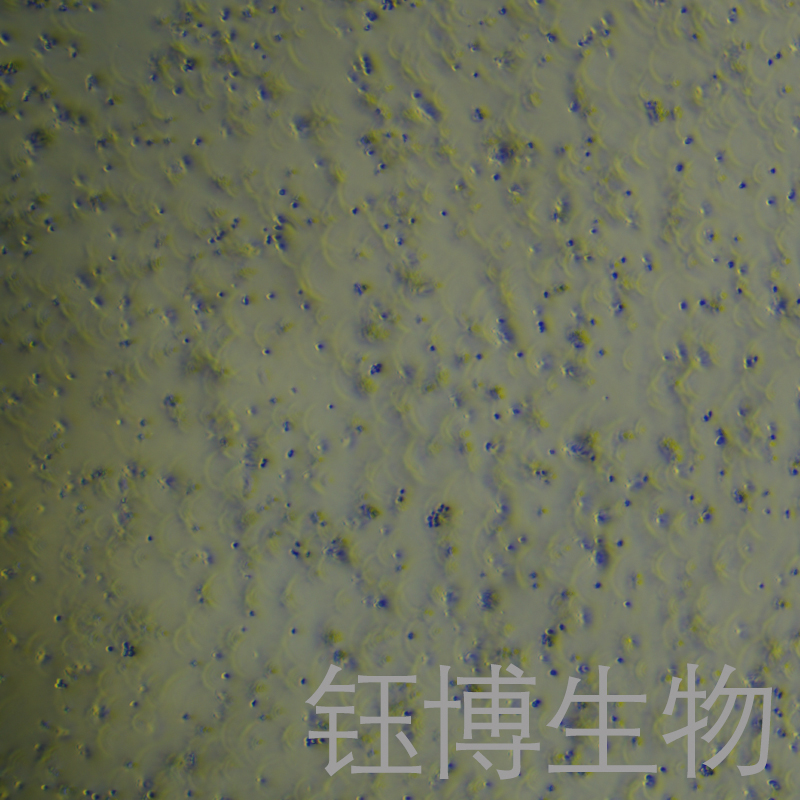 Nalm-6（人B淋巴白血病细胞）YB-71782HC,Nalm-6