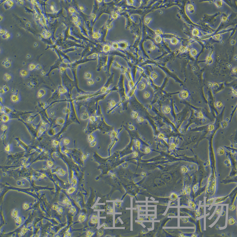 U251/GFP（人神经胶质细胞瘤细胞带绿色荧光）YB-71786HC,U251/GFP