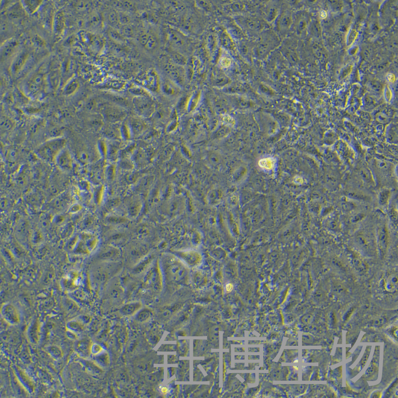 SNU182（人肝癌细胞）YB-71789HC,SNU182