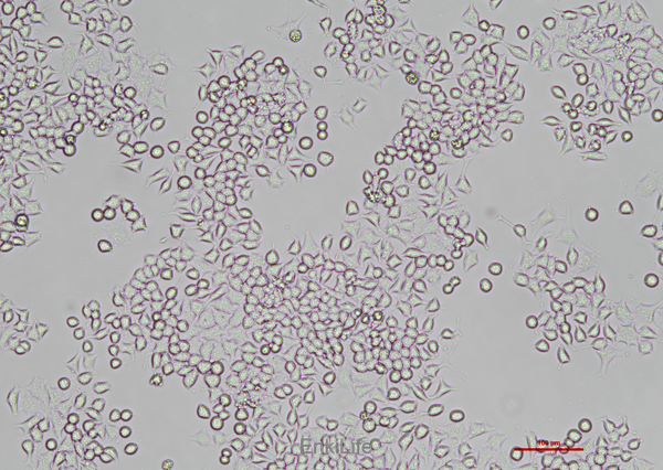 大鼠胰岛β细胞瘤细胞RIN-m5f