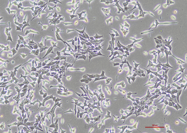 大鼠胰岛细胞瘤细胞INS-1