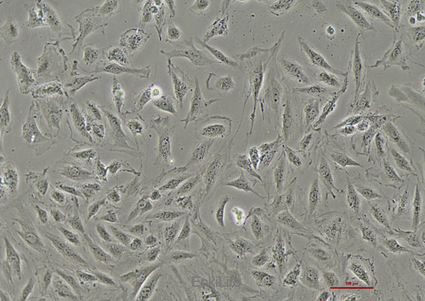 大鼠正常肾成纤维细胞NRK-49F