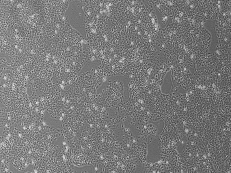 人大肠癌细胞CX-1