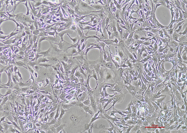 人胆管细胞型肝癌细胞Hccc9810