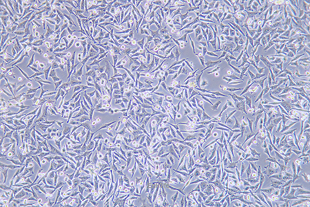 人恶性黑色素瘤细胞A375