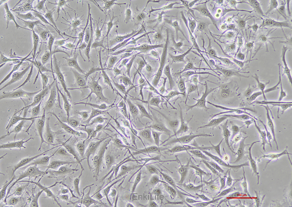 人恶性黑色素瘤细胞SK-MEL-28