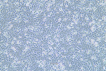 人非小细胞肺癌细胞NCI-H358