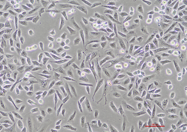 人肺癌细胞NCI-H1703 [H1703]